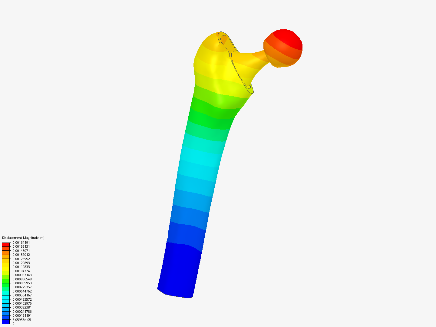Hip joint prosthetis by ksenia simscale