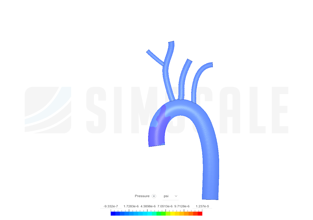 Blood flow simulation by Yahira | SimScale...