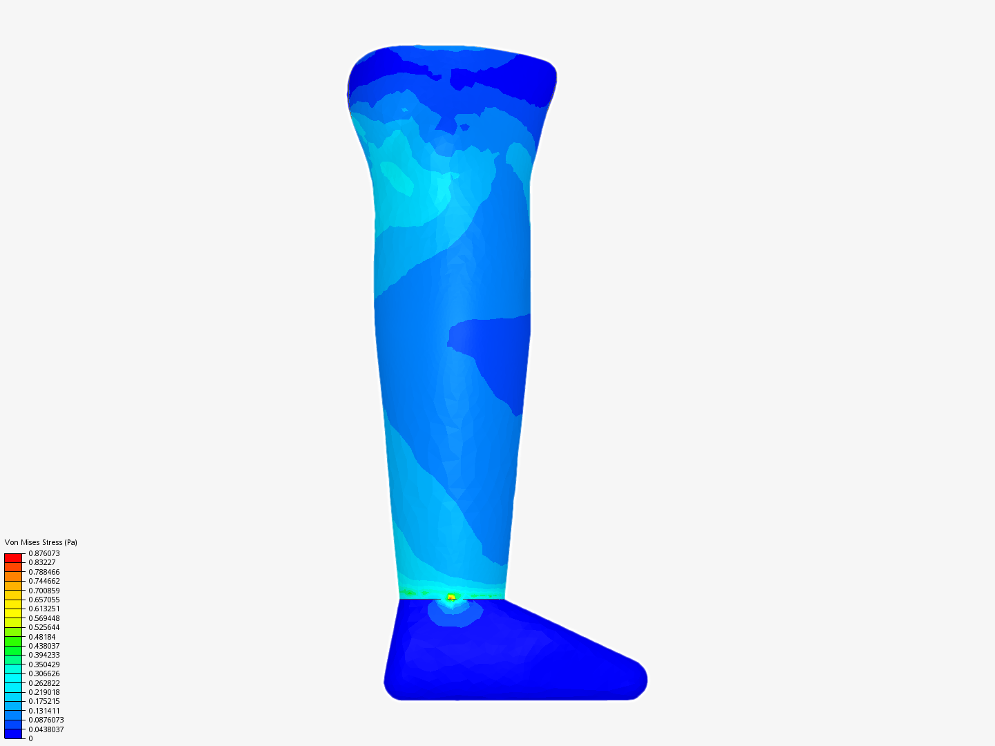 Prosthetic leg image