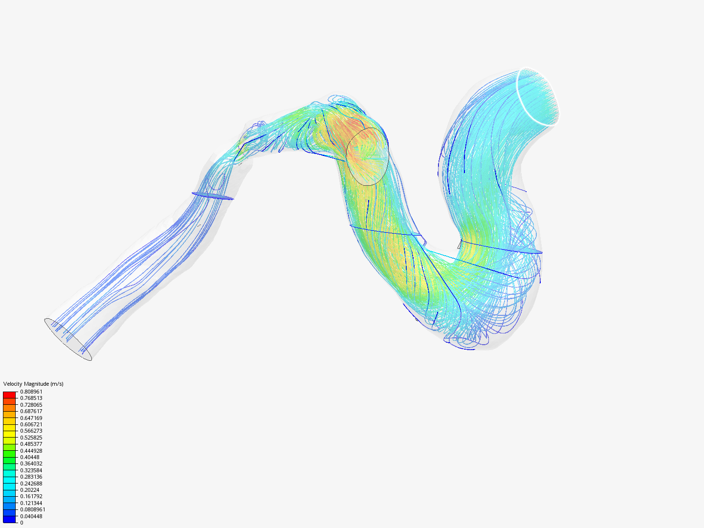 Blood_flow by dianlabaken | SimScale...
