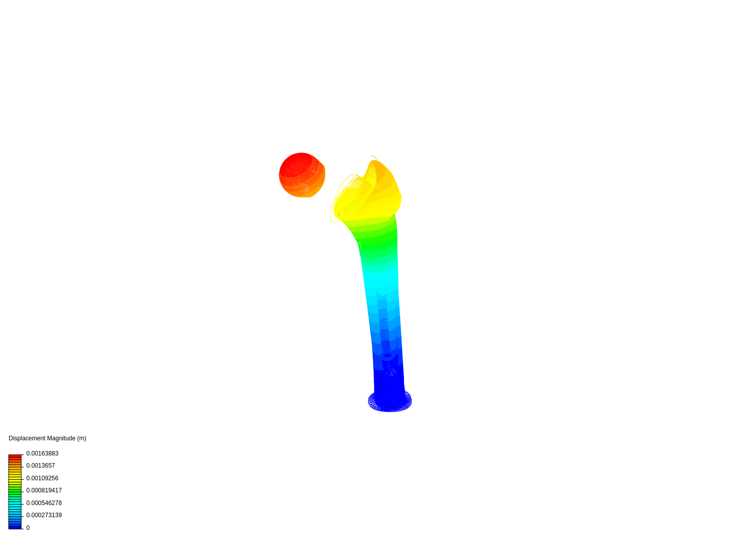 hip joint prosthesis by grvpwr399 | SimScale