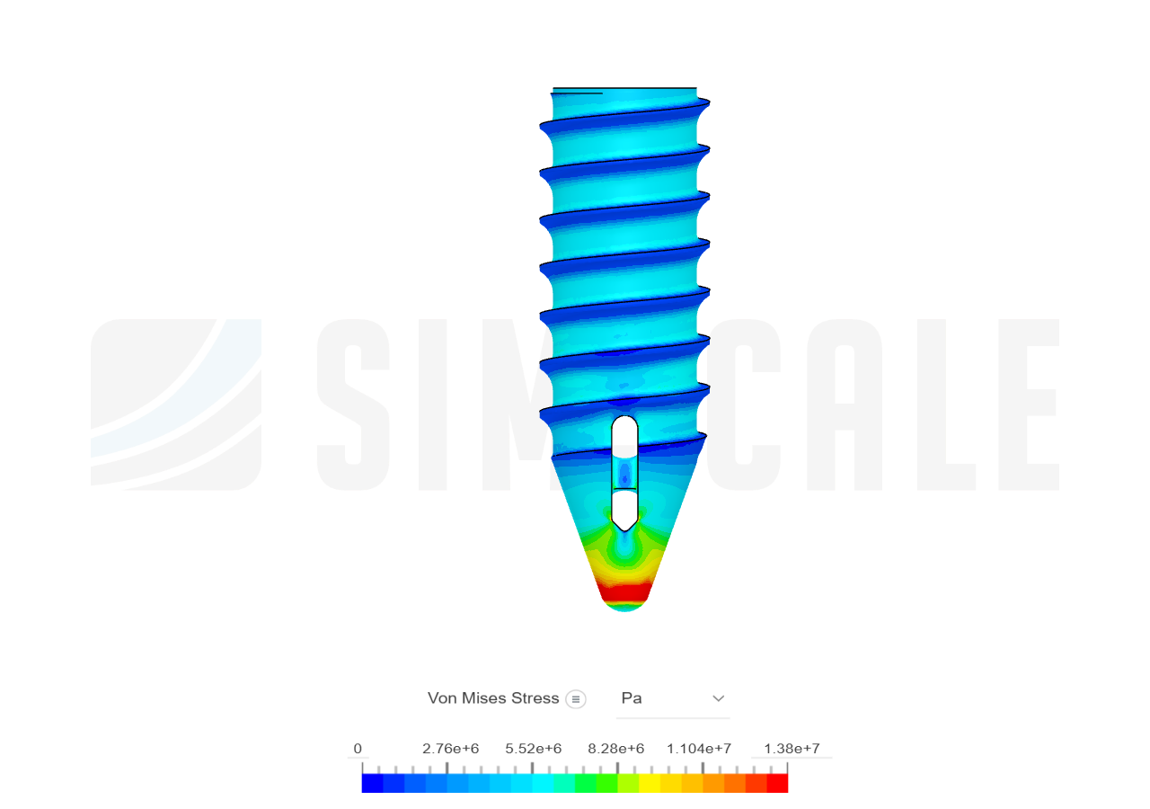 Suture Anchor V2.4 - use by jmunoz3015 | SimScale