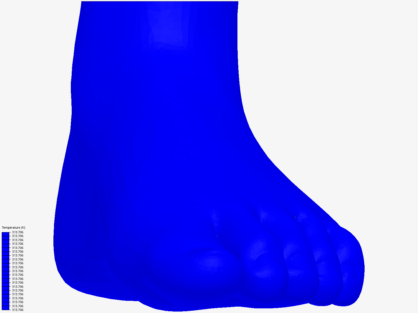 Foot Thermal image