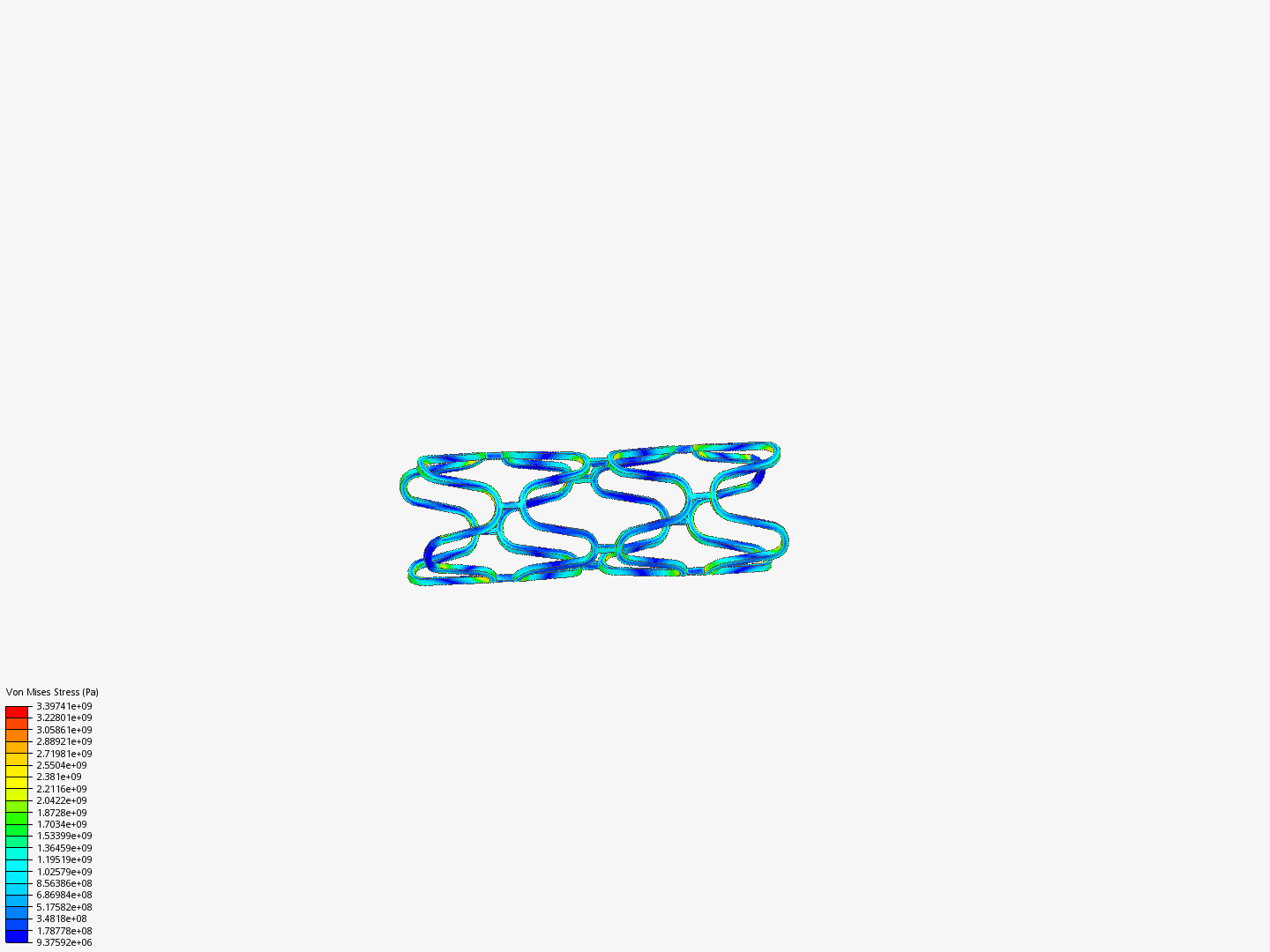 Heart stent by lisper | SimScale...