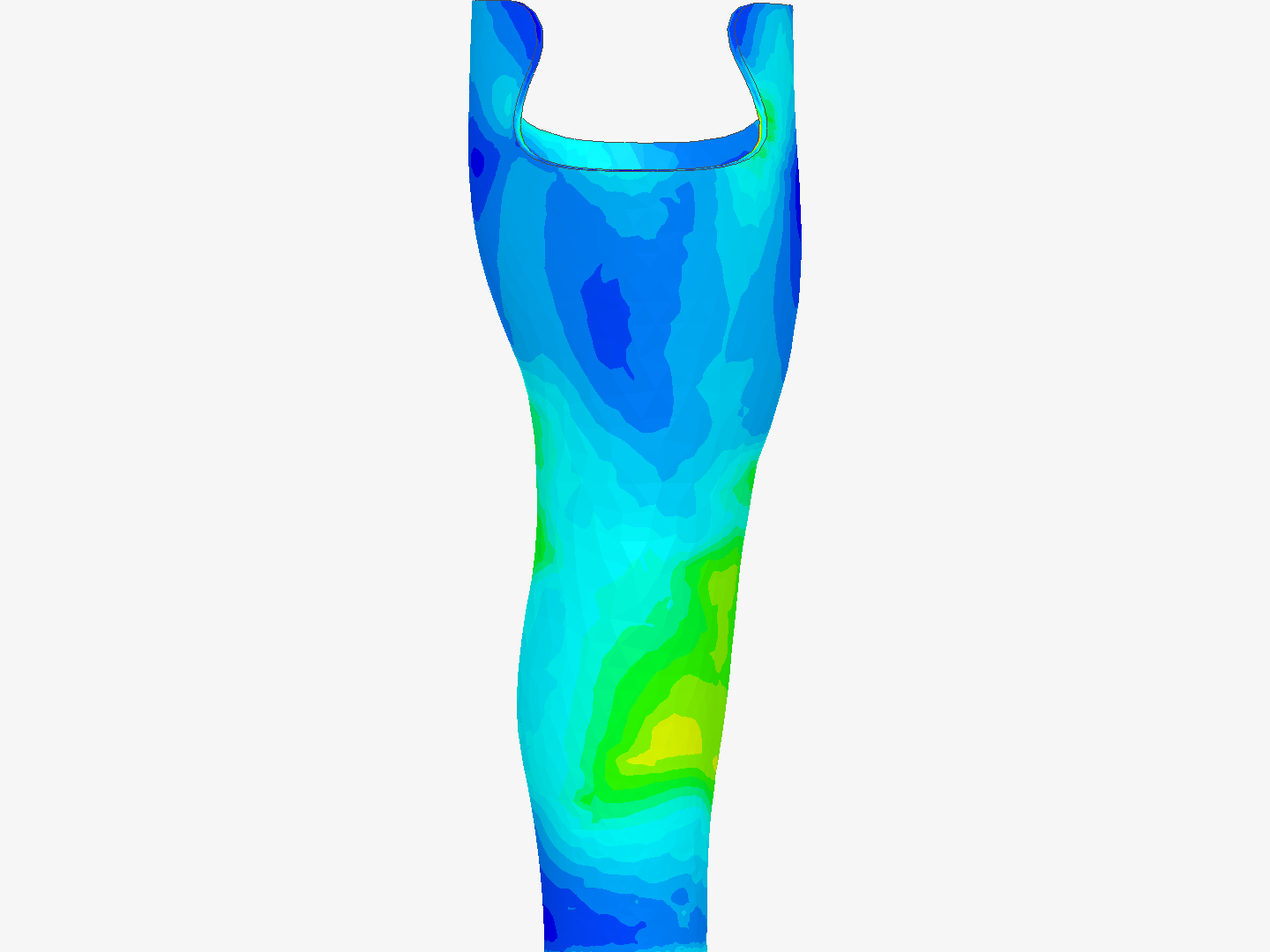 Socket_FEA_Study_3mm by phuongpham2712 | SimScale...