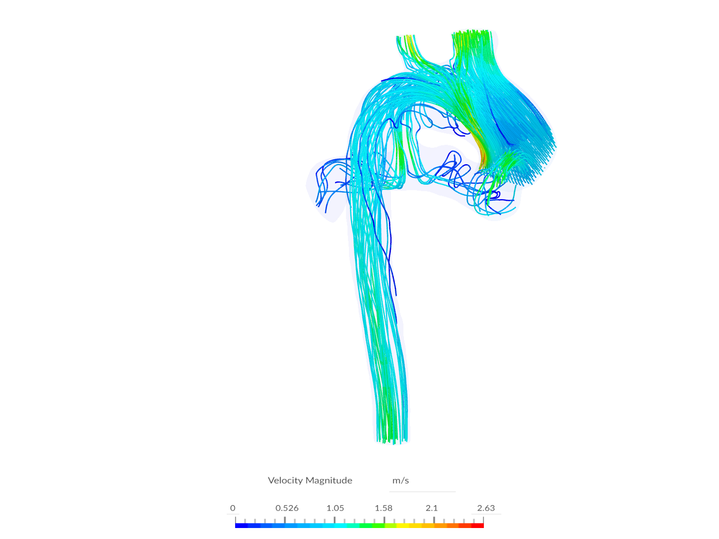 patient7_ravza_shuntedversion_pdaopen image