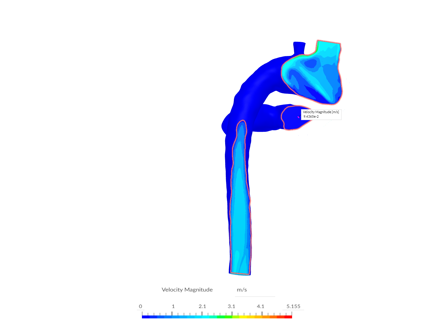 patient7_ravza_shuntedversion image