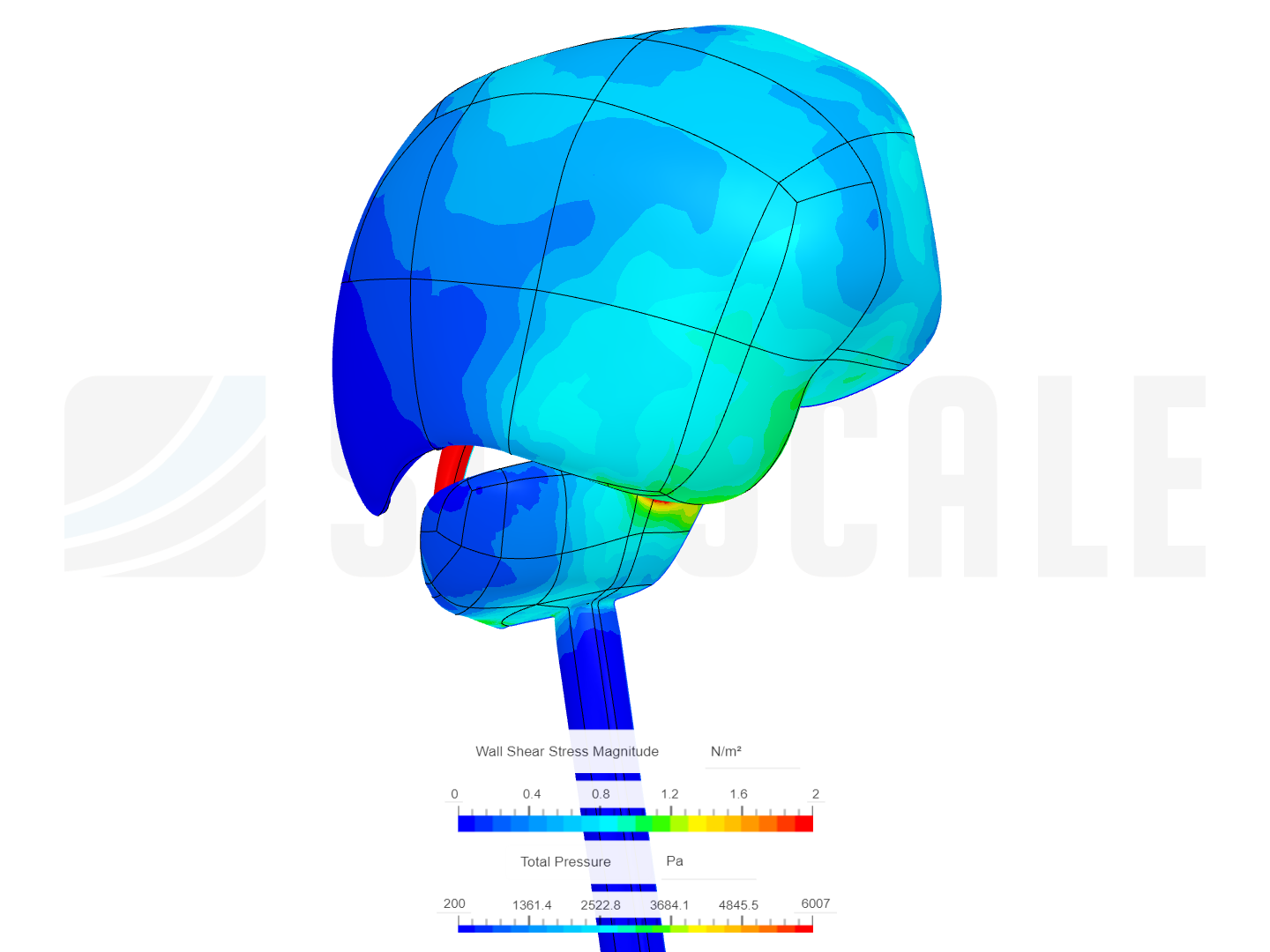 Quadrigeminal Cisternostomy For NBH image