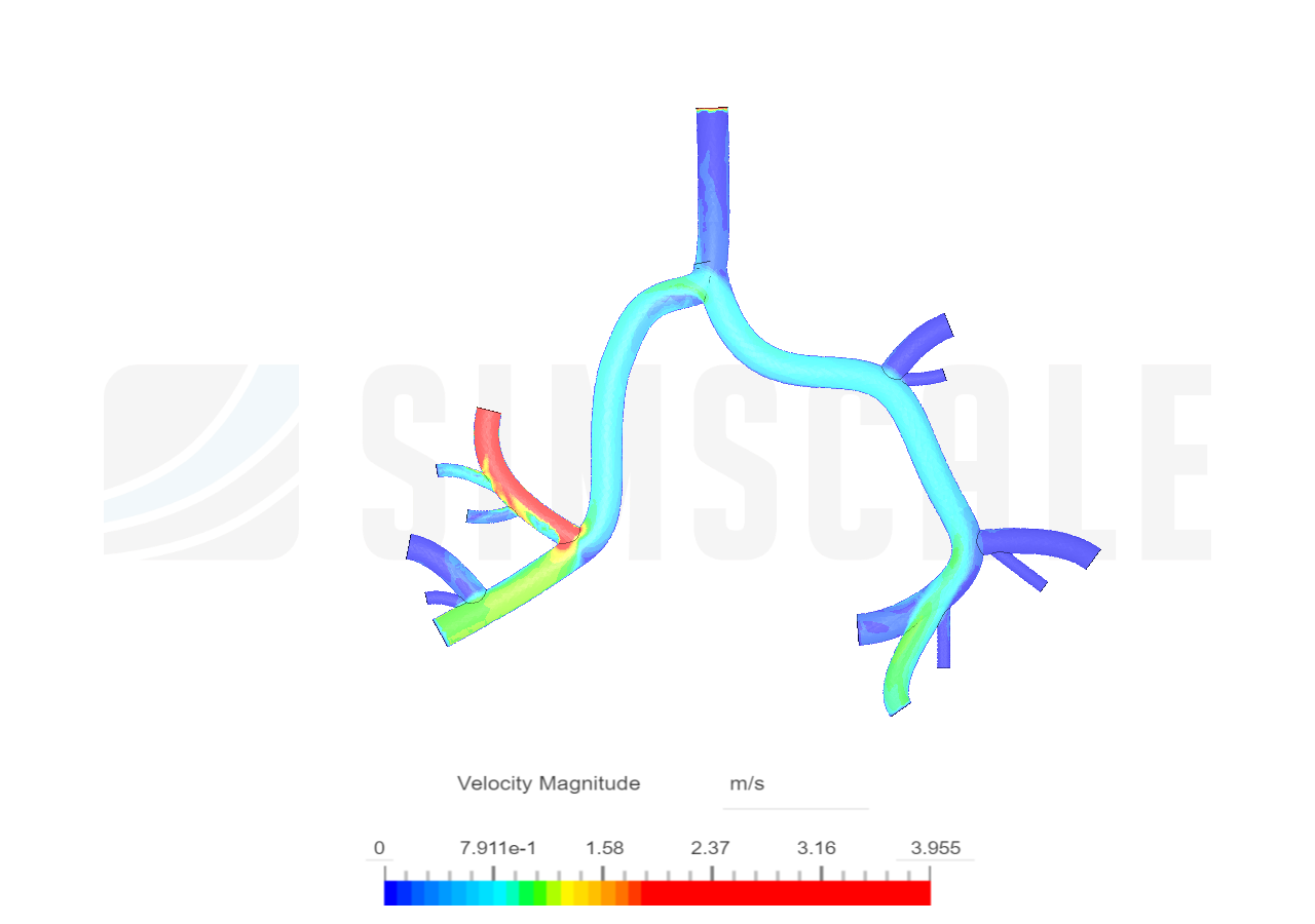 Airway_simscale by talieha_grant | SimScale