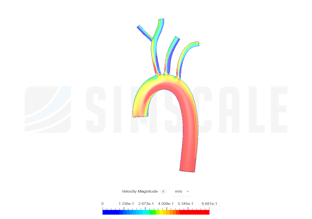 Blood Flow Simulation by tdedrick | SimScale...