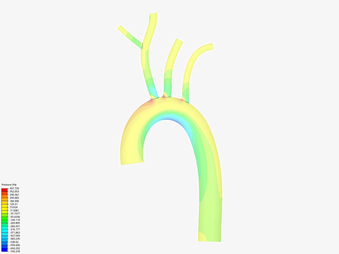Blood Flow Simulation by tivonia_daley | SimScale...