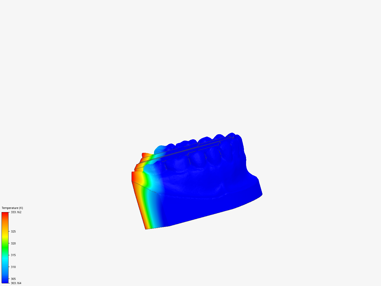 Heat transfer analysis of dental plaster image