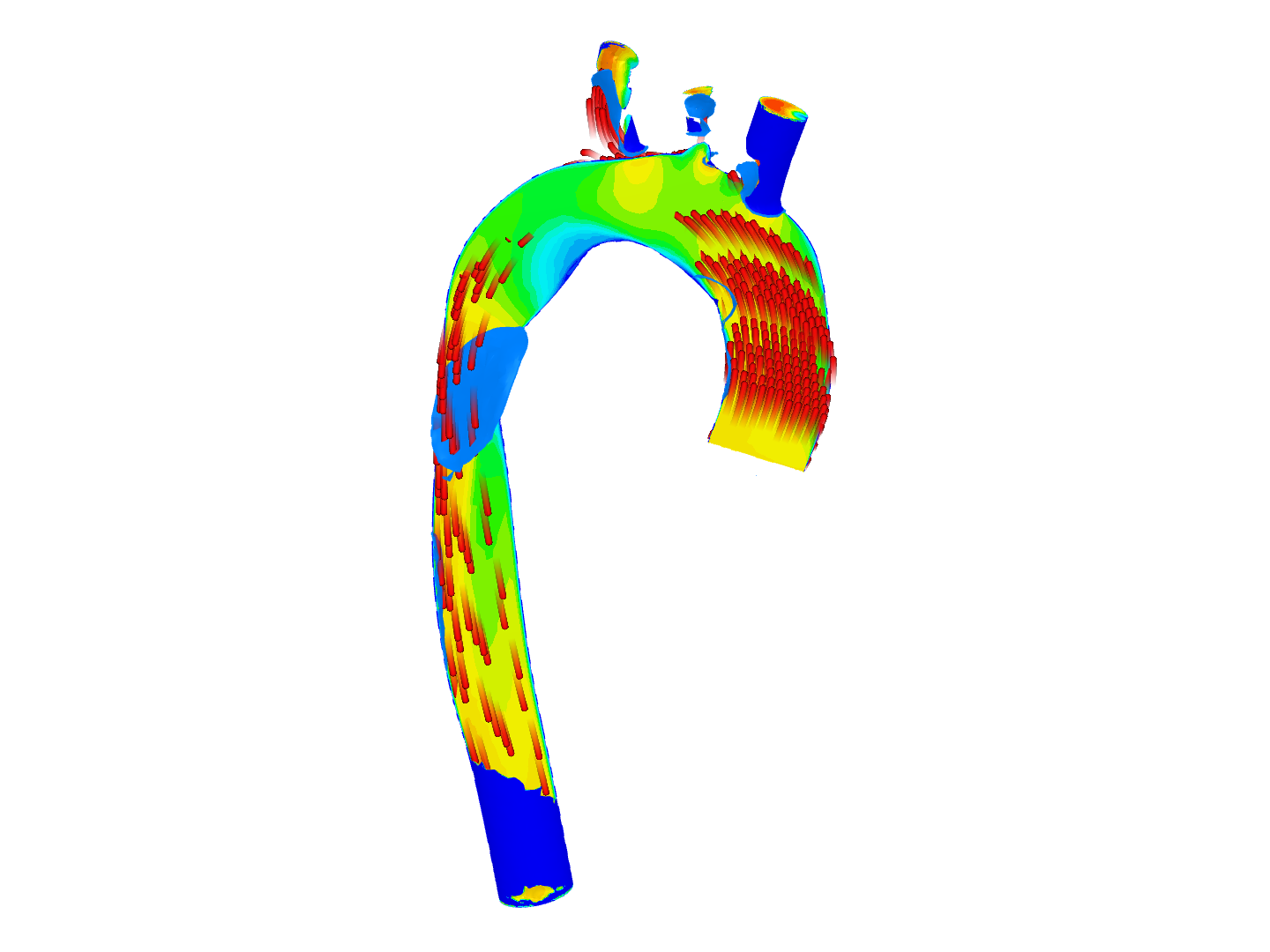 Final aorta image