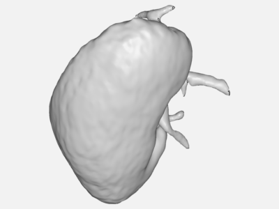 Kidney Model by mfrancooly | SimScale