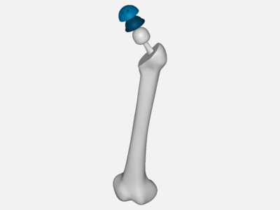 hip joint (4) image