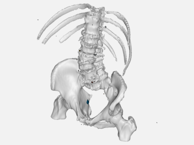 Spine image