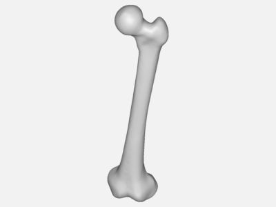 hip joint image