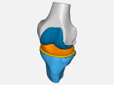FEA-knee prosthesis image