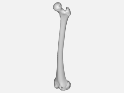 bone analysis image