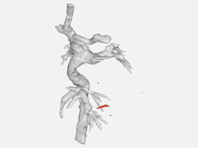 aorta image