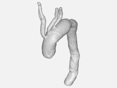 Aortic Blood Flow Simulation image