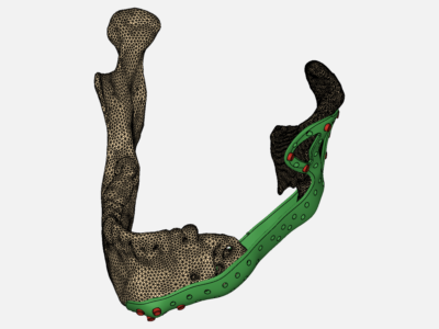 Prótesis de cadera image