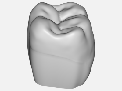 Tooth Restoration Class II MOD image