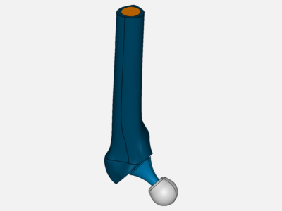 cemenntless hip stem prosthesis image