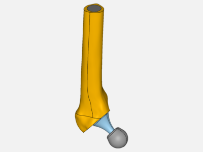 Hip Joint Prosthesis image