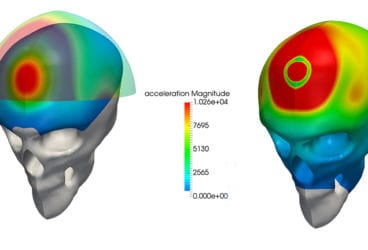 Stress analysis of a skull with and without a helmet carried out with SimScale, CAE computer-aided engineering