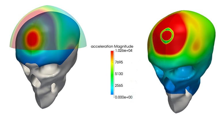 Stress analysis of a skull with and without a helmet carried out with SimScale